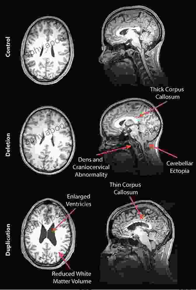 Brain Scan Depicting Individual Differences In Imaging Individual Differences In Imaging: Their Measurement Origins And Consequences (Imagery And Human Development Series)