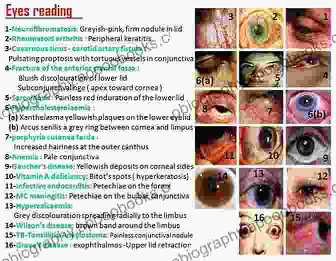 Overview Of Common Eye Diseases And Their Symptoms An Outline Of Ophthalmology Roger L Coakes