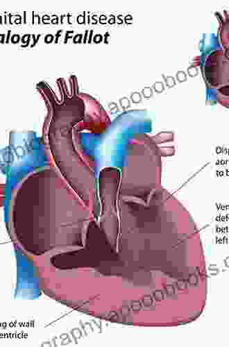 The Right Ventricle in Adults with Tetralogy of Fallot